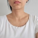 디어멍 | 목주름주사 콜라겐 디어넥주사 효과 후기