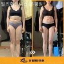 발리휘트니스 이미지