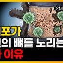 뼈 전이, 단순한 '운'이 아닙니다. 암세포가 파고드는 뼈의 비밀과 필수 영양소 5가지 / 골다공증, 골밀도, 암재발, 항암, 칼슘, 이미지