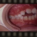 지엘치과기공소 이미지