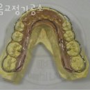 이음치과기공소 이미지