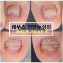 레푸스 구로점 | 천안 내성발톱 관리 레푸스 천안두정점, 발관리 전문샵에서 1:1 맞춤 케어 받은 후기
