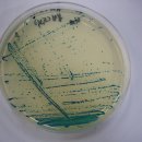 Brilliance Bacillus cereus Agar 판독.... 이미지