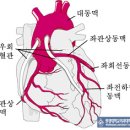관상동맥질환(협심증,심근경색)과 치료방법 이미지