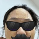 부영약국 | 비립종제거 후기, 가격 , 비립종제거후 관리 방법 (메이퓨어의원미아점)