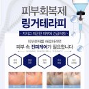 샤이닝테라피