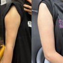 우람동물병원 | [유라인] 💪 팔뚝컷주사 유라인클리닉 지방분해주사 후기! 예비신부의 팔뚝살 고민 해결기 ㅎㅎ