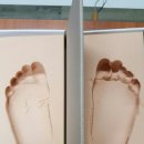 추석명절에 보는 책 : The Functional Foot Orthosis 이미지