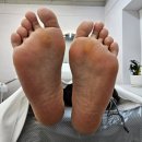 홍대 발각질관리 여름맞이 패디플래닝 홍대 달콤네일&amp;래쉬