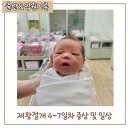 제왕절개 후 4~7일차 후기 및 한아름병원 입원일상