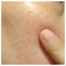 ㈜에바스코스메틱 | 피부 진정젤 로즈마인 아줄렌 카밍겔 알로에젤추천