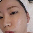 강남 피부한의원 피부결개선 캐비어리빌더 후기