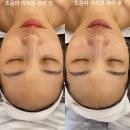 위례피부관리 올가드림뷰티 송파위례점