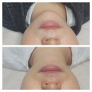 해움플래닝 | [영등포 피부관리] 바로 느껴지는 스페셜 리프팅 관리 후기✨ - 해움에스테틱