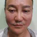 카이로스성형크리닉 네이버블로그