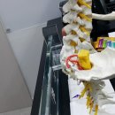 MUSCLE FLOW | 허리디스크 오래 서 있으면 무조건 통증이 증가하는 이유