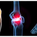 서울조인스정형외과의원 이미지