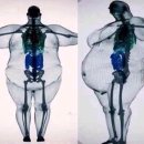 요요 봉담점 | 위고비보다 저렴하고 효과 좋은 비만치료제? &#39;마운자로&#39; 알아보기! [봉담 PT/ 봉담 헬스]