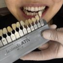 시온의빛치과교정과치과의원 | [치아 미백 추천] 강남 임플라인치과 + 치아노트 앱 후기 🦷✨