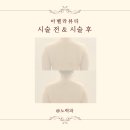 탄방동 아벨라뷰티 신부관리(등관리·승모근관리) 후기