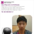 박승철위그스튜디오 남자부분가발 후기/강북구/노원구/종로구/도봉구/중랑구/맞춤가발