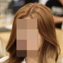 스펠라 헤어 메디컬 이미지