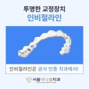 석치과의원 | 덧니 교정 비용과 효과, 발치 여부? 치과교정과전문의가 알려드릴게요! 노원 덧니 교정