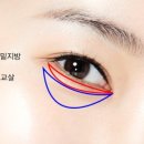 비해피이상양의원 네이버블로그