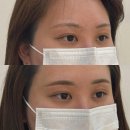 자연-이미지 | 홍대눈썹문신 원하는 자연눈썹 분위기에 맞춰 이미지 변화 대성공 후기