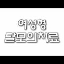 모발이식,모발이식비용- 여성형탈모, 모발이식으로 가능하다. (모발이식수술비용,황성주털털 모발이식센터) 이미지