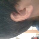 예스보청기 이미지