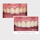 다빈치치과기공소 이미지