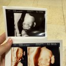 억부닭발 | 11.2 미래로병원 21주 2차정밀초음파검진 후기