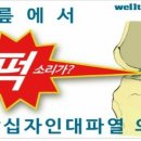 전방십자인대 파열의 원인과 증상 이미지