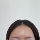 오즈헤어라인 이미지