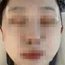 맑은린 | [광주 첨단 에스테틱] ‘맑은린에스테틱’ 얼굴 붓기 쫙 빠진 베이직 윤곽관리 후기
