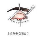 굿아이금천이안과