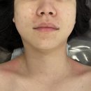 [김해웨딩관리/김해등관리] 바이민스킨앤바디 트러블케어 솔직후기