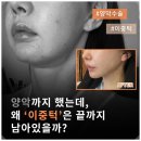 리얼성형외과의원 | 양악했는데 이중턱 그대로? SMAS부터 정리한 리얼 브이리프트 후기 [다움성형외과 김대현 원장]