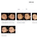 뷰티온의원 별내점 이미지