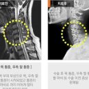 손저림 원인 팔이 저린 이유 알아보기 이미지