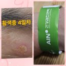 주안퀸와이비여성의원 | 유방암 검사 자궁경부암검사 황색종ㅜ