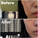 (주)리율 | 원주 관설동 피부관리 리율 에스테틱 팩으로 리프팅관리