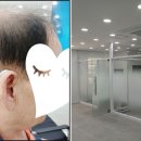 스마트히어링 대구점 이미지