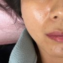 옥산초등학교 | 경산 윤곽관리 백설공주 에스테틱 페이스 윤곽관리 후기