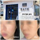 구미피부관리 형곡 다인스킨케어 후기 숨결클렌징으로 피부장벽 케어