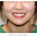 OK미소치과의원 네이버블로그