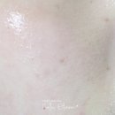 모닝리페어 이미지