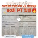 비육단지 | [영천 창신 PT 추천] 지방간으로 고생하던 30대 직장인, PT로 현실적인 변화 비포에프터!