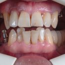 청플란트치과의원 이미지